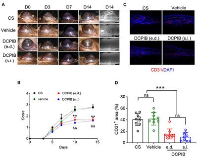 4-(2-Butyl-6,7-dichloro-2-cyclopentyl-indan-1-on-5-yl) oxobutyric acid inhibits angiogenesis via modulation of vascular endothelial growth factor receptor 2 signaling pathway